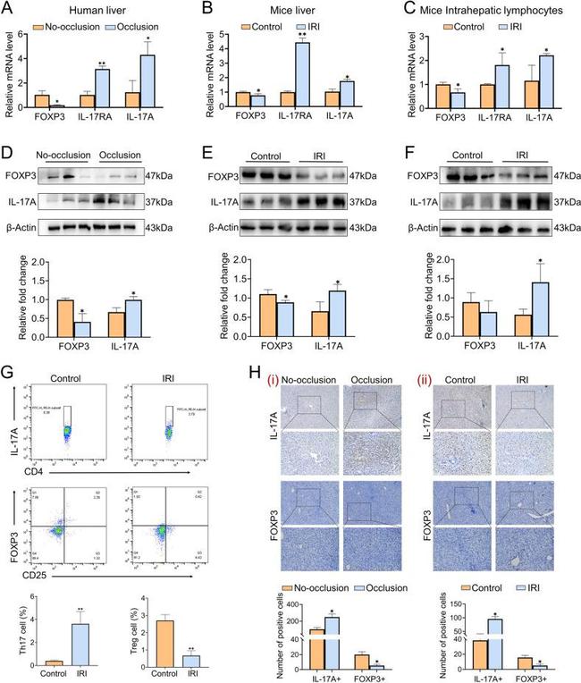 IL-17A Antibody in Immunohistochemistry (Paraffin) (IHC (P))