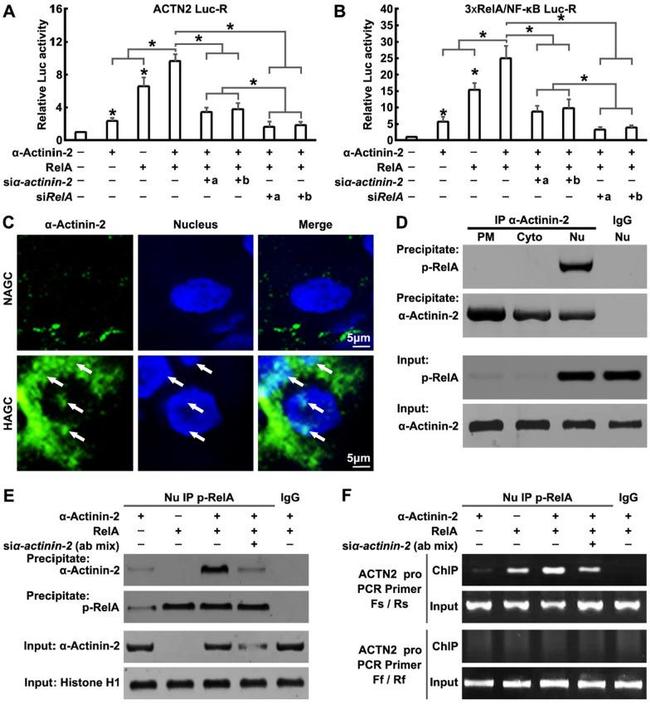 alpha Actinin 2 Antibody in Western Blot, Immunoprecipitation (WB, IP)