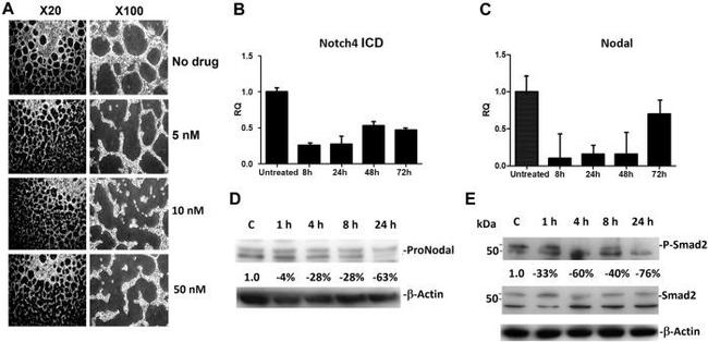 Phospho-SMAD2 (Ser465, Ser467) Antibody in Western Blot (WB)