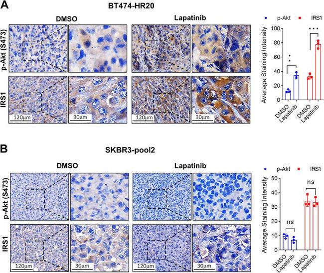 IRS1 Antibody in Immunohistochemistry (Paraffin) (IHC (P))