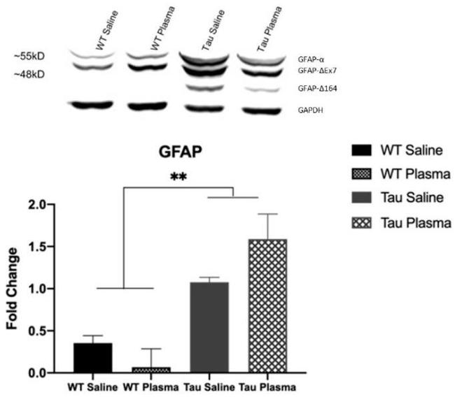 GFAP Antibody in Western Blot (WB)