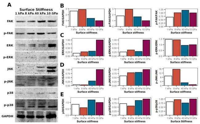 p38 MAPK Antibody in Western Blot (WB)