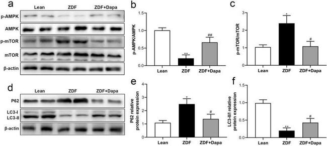 LC3A/LC3B Antibody in Western Blot (WB)