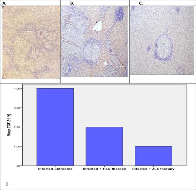 TGF beta-1 Antibody in Immunohistochemistry (Paraffin) (IHC (P))