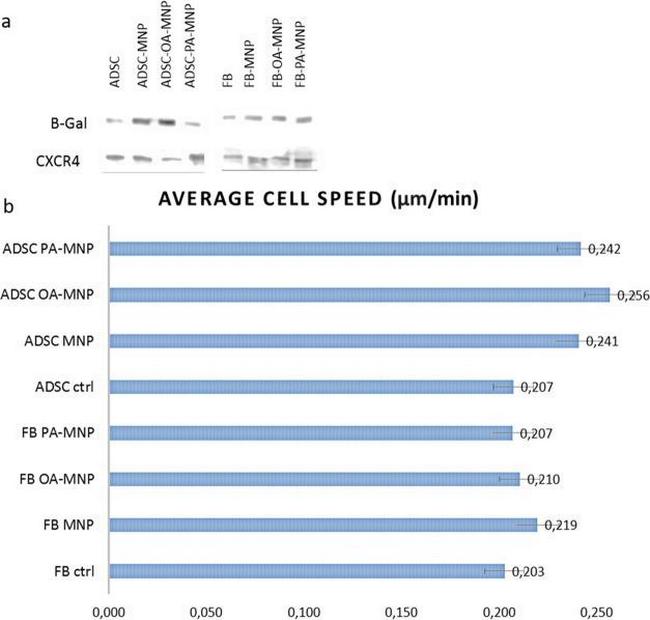 beta Galactosidase Antibody in Western Blot (WB)