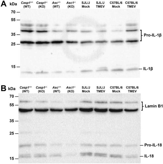 IL-1 beta Antibody in Western Blot (WB)