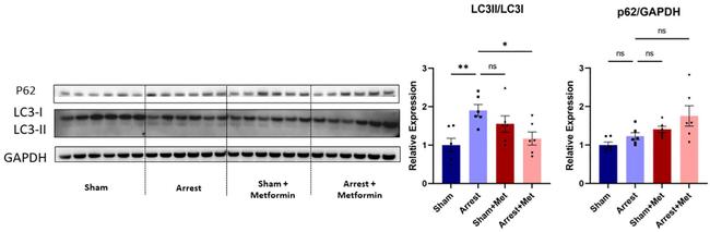 LC3A/LC3B Antibody in Western Blot (WB)