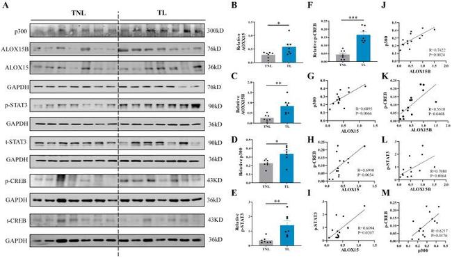 ALOX15 Antibody in Western Blot (WB)