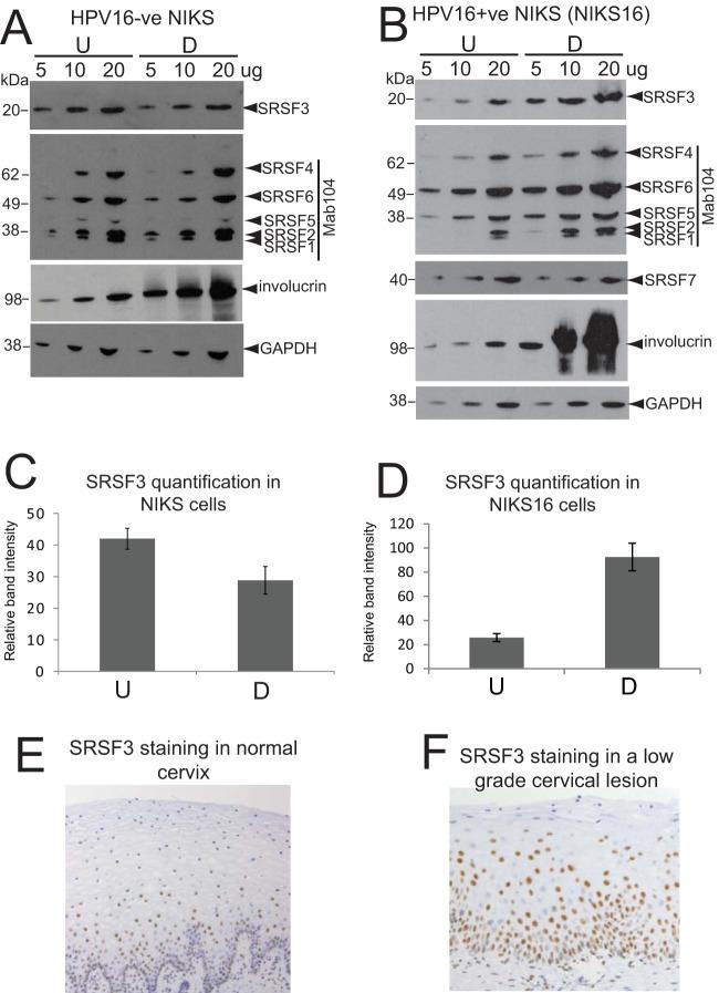 SRSF3 Antibody in Western Blot, Immunohistochemistry (WB, IHC)