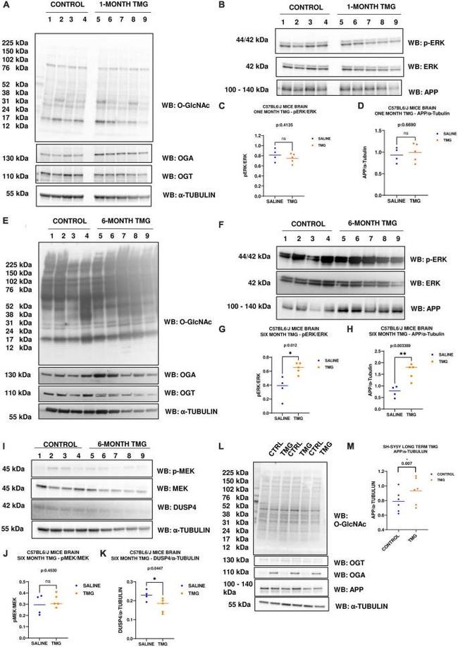 O-linked N-acetylglucosamine (O-GlcNAc) Antibody in Western Blot (WB)