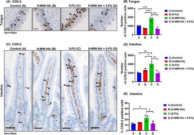 COX2 Antibody in Immunohistochemistry (Paraffin) (IHC (P))