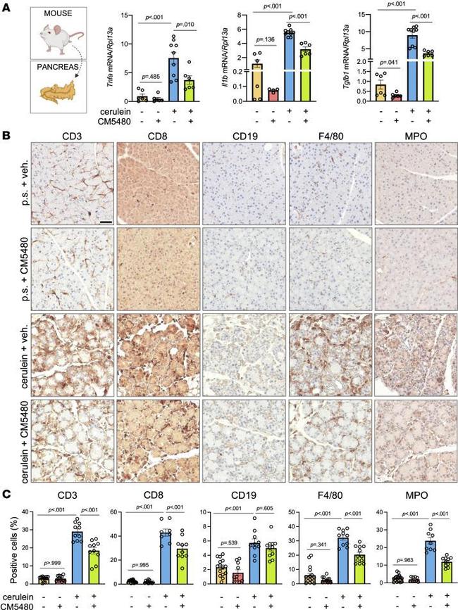 CD19 Antibody in Immunohistochemistry (Paraffin) (IHC (P))