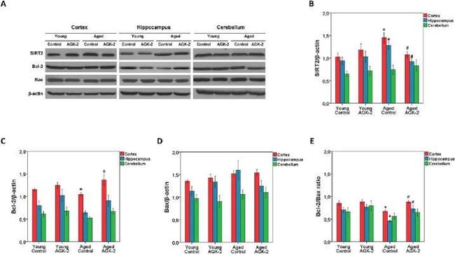 Bcl-2 Antibody in Western Blot (WB)