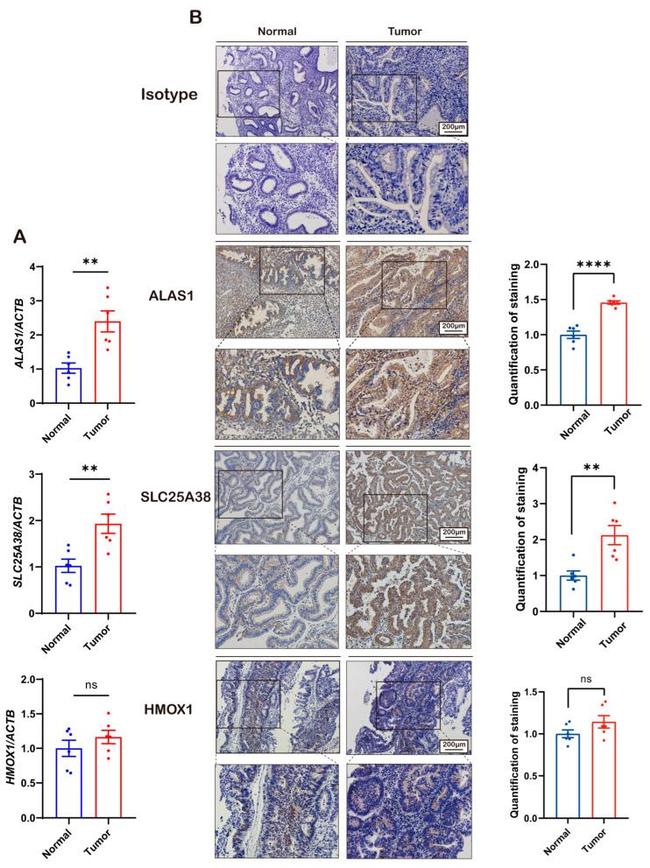 SLC25A38 Antibody in Immunohistochemistry (Paraffin) (IHC (P))