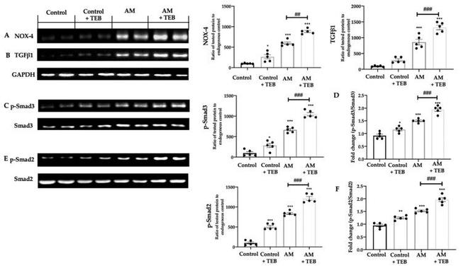 NOX4 Antibody in Western Blot (WB)