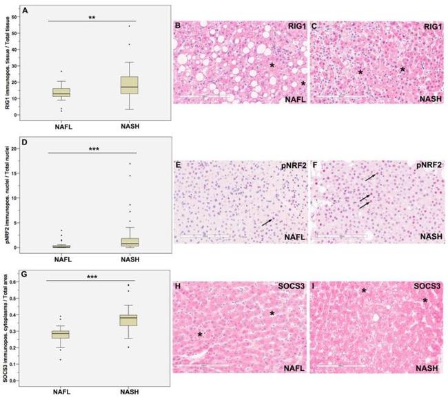 RIG-I Antibody in Immunohistochemistry (Paraffin) (IHC (P))