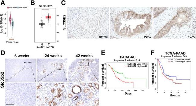 SLC35B2 Antibody in Immunohistochemistry (Paraffin) (IHC (P))