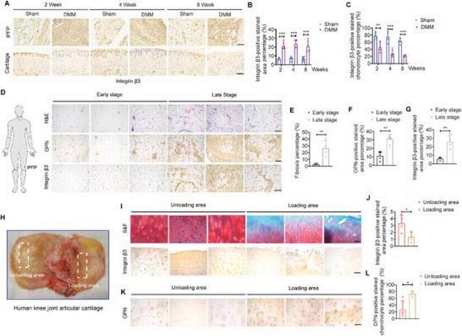 CD61 (Integrin beta 3) Antibody in Immunohistochemistry (Paraffin) (IHC (P))