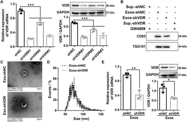 VDR Antibody in Western Blot (WB)