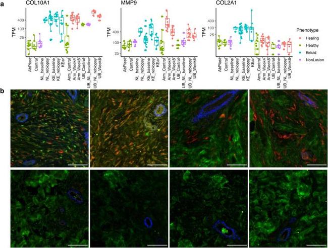 Collagen II Antibody in Immunohistochemistry (Paraffin) (IHC (P))