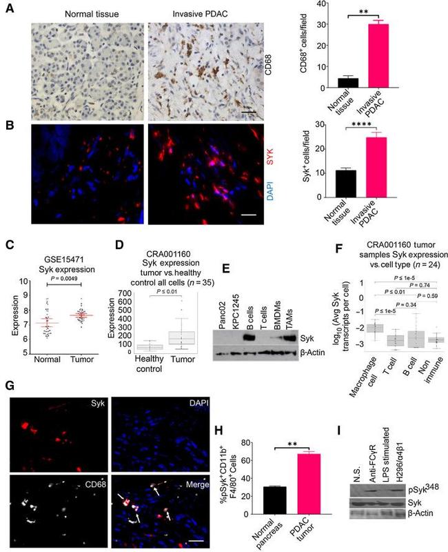 CD68 Antibody in Immunohistochemistry (Paraffin) (IHC (P))