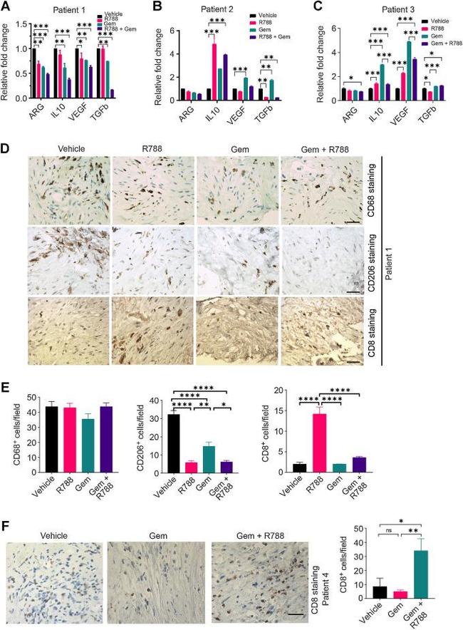 CD68 Antibody in Immunohistochemistry (Paraffin) (IHC (P))