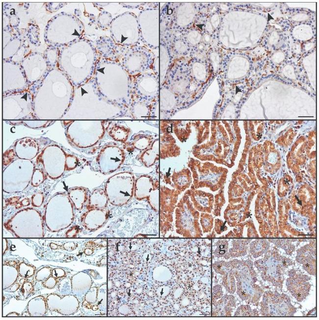 Furin Antibody in Immunohistochemistry (IHC)