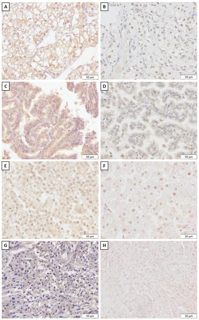 SNAIL Antibody in Immunohistochemistry (Paraffin) (IHC (P))