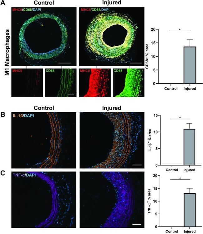 IL-1 beta Antibody in Immunohistochemistry (Paraffin) (IHC (P))