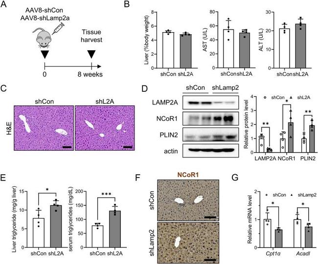 NCoR1 Antibody in Immunohistochemistry (Paraffin) (IHC (P))