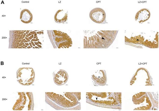 Claudin 1 Antibody in Immunohistochemistry (Paraffin) (IHC (P))