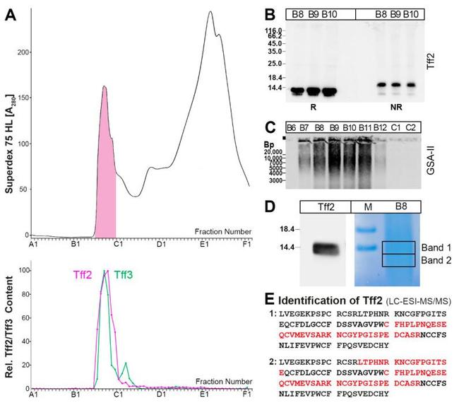 TFF2 Antibody in Western Blot (WB)