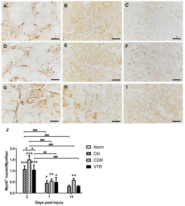 MYOD Antibody in Immunohistochemistry (Frozen) (IHC (F))