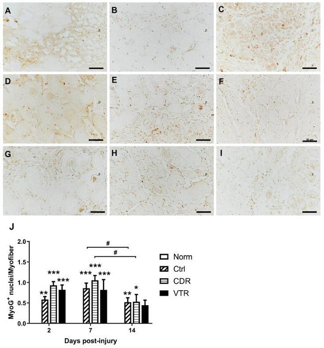 Myogenin Antibody in Immunohistochemistry (Frozen) (IHC (F))