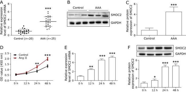 SMOC2 Antibody in Western Blot (WB)