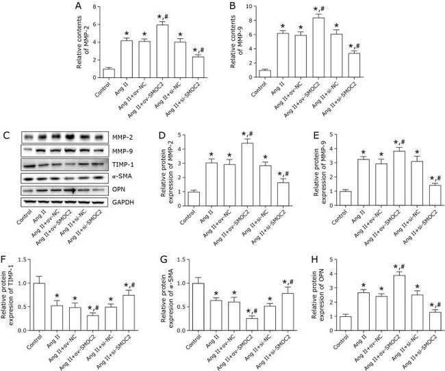 Osteopontin Antibody in Western Blot (WB)