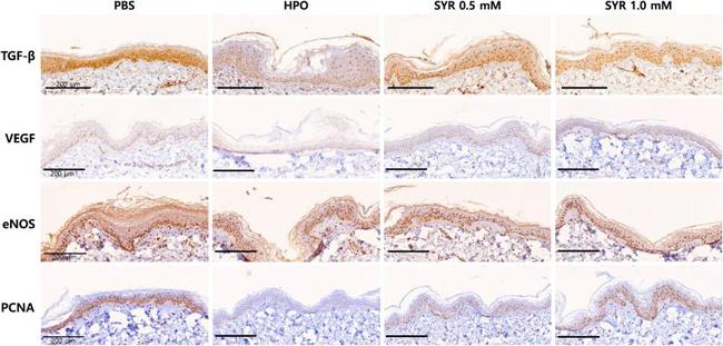 eNOS Antibody in Immunohistochemistry (IHC)