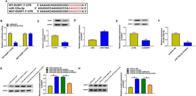 MKP-1 Antibody in Western Blot (WB)