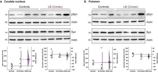 alpha Synuclein Antibody in Western Blot (WB)