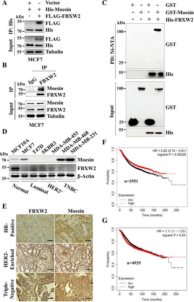 Moesin Antibody in Immunohistochemistry (Paraffin) (IHC (P))