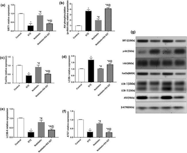 LC3B Antibody in Western Blot (WB)