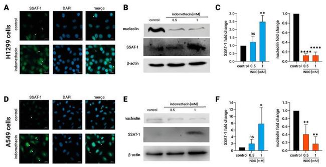 Nucleolin Antibody in Western Blot (WB)