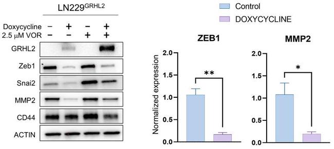 GRHL2 Antibody in Western Blot (WB)