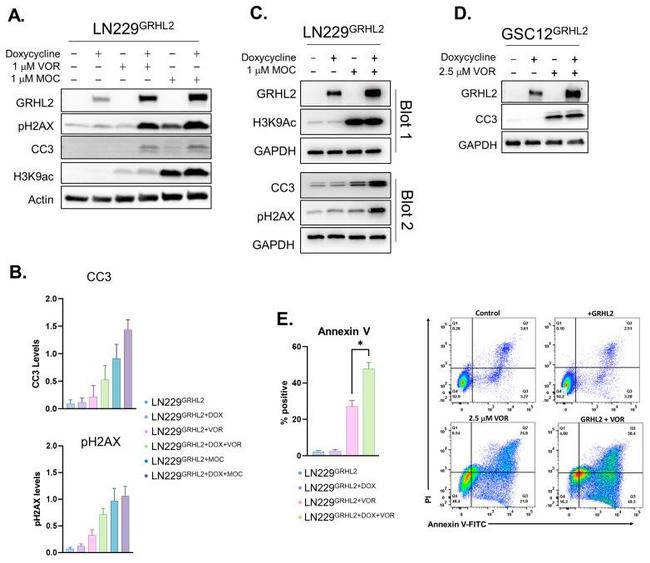 GRHL2 Antibody in Western Blot (WB)