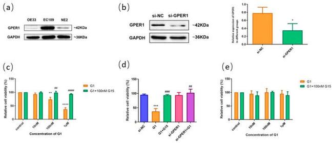 GPR30 Antibody in Western Blot (WB)