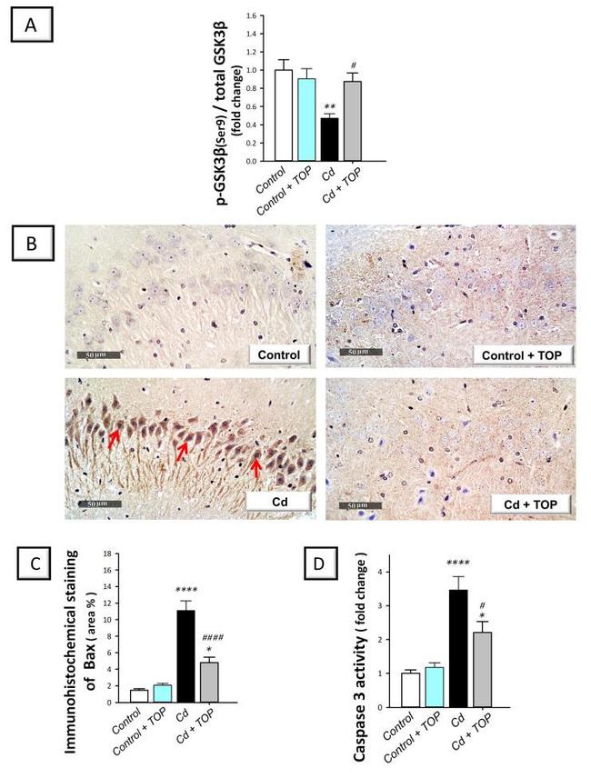 Bax Antibody in Immunohistochemistry (Paraffin) (IHC (P))