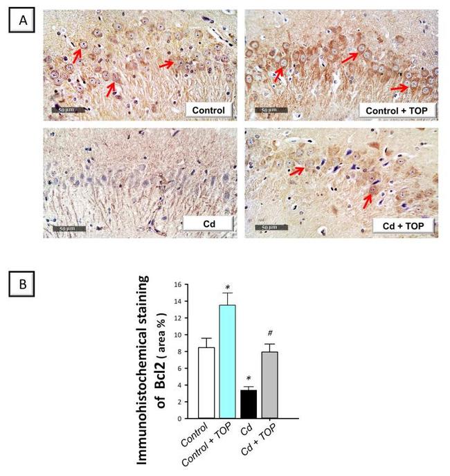 Bcl-2 Antibody in Immunohistochemistry (Paraffin) (IHC (P))