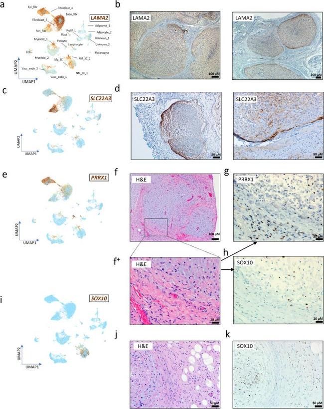 PRRX1 Antibody in Immunohistochemistry (Paraffin) (IHC (P))