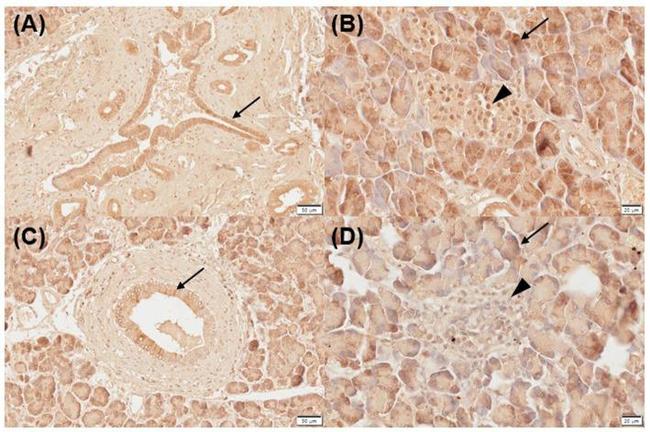 VDR Antibody in Immunohistochemistry (Paraffin) (IHC (P))