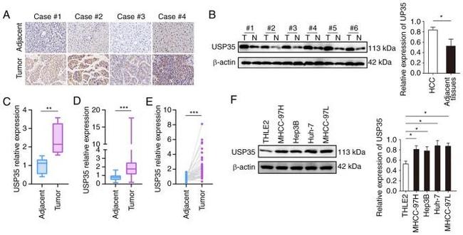 USP35 Antibody in Western Blot (WB)